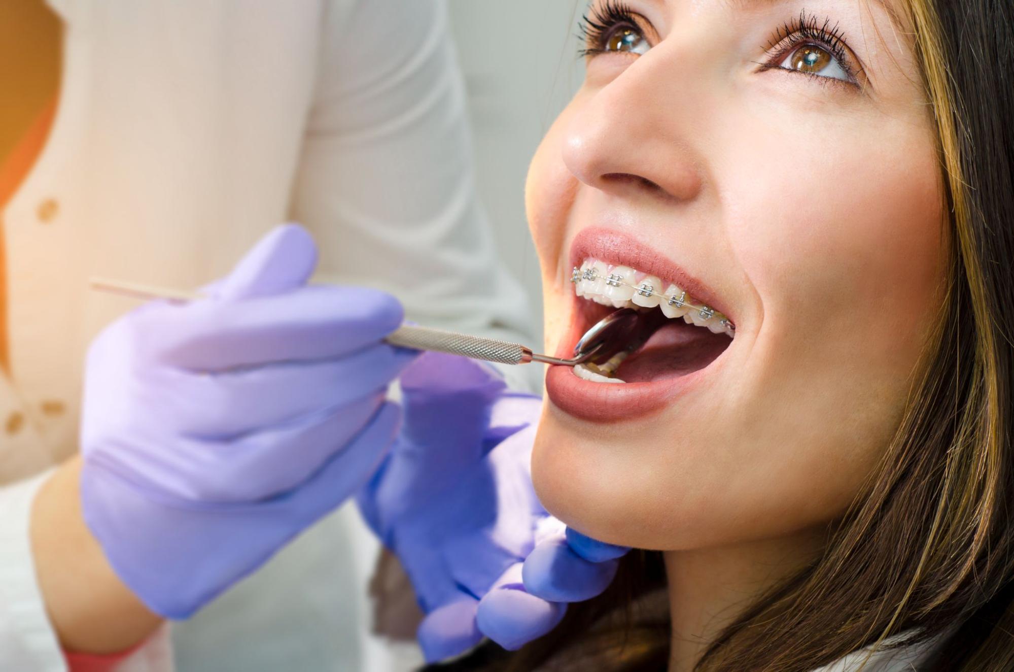How Long Does Orthodontic Treatment Take?
